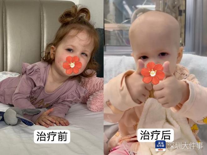 基因治療“逆天改命”！瑞典罕見遺傳病患兒萬里赴粵重獲新生(圖2)